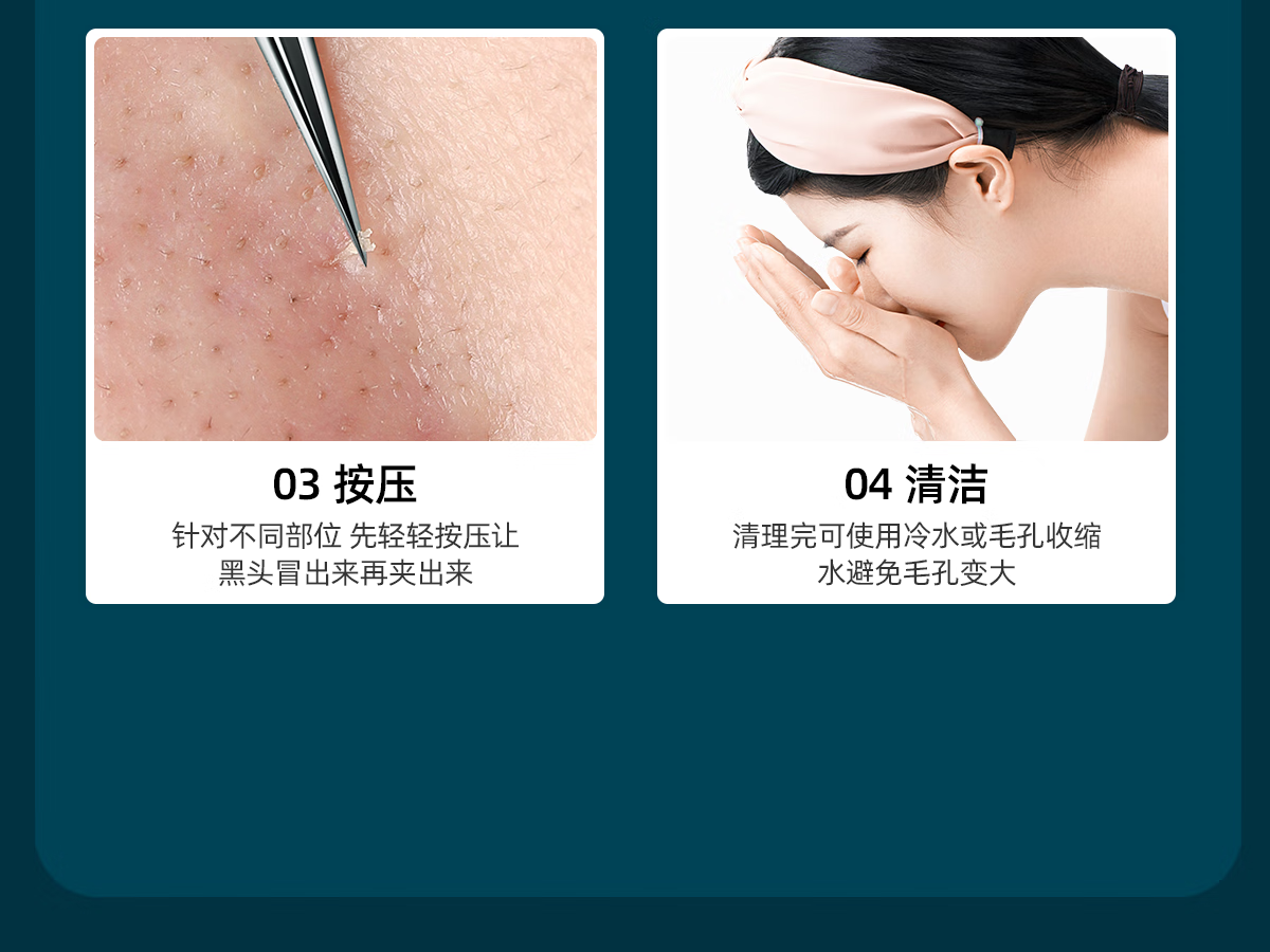 欧亿姿（oeiez） 5号超尖细胞夹美容院专用祛黑头夹暗疮针超细粉刺针套装挑痘工具 超尖细胞夹【0.1mm】三只组合装