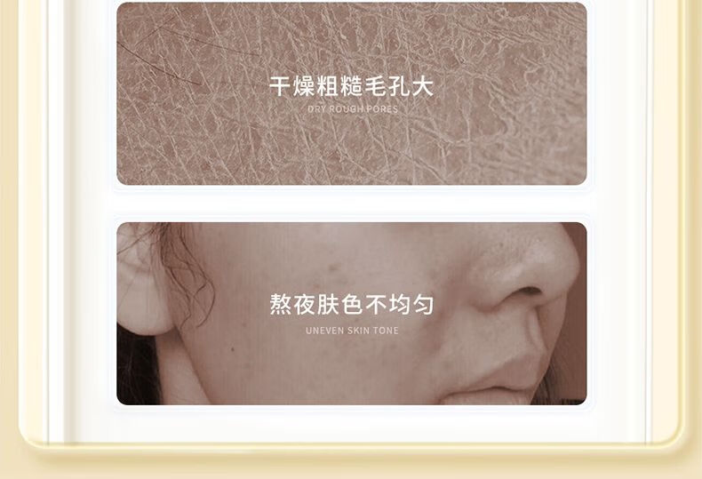 碧奥泉维生素E补水精华液维e软胶囊涂痘印保湿亮肤嫩肤乳男女士学生 维E精华1瓶+维E乳2瓶
