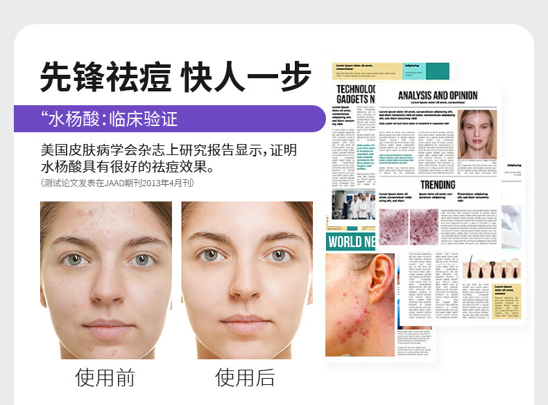 DRDM祛痘精华液水杨酸抗痘去闭口粉刺修护痘肌原液控油淡化痘印 20ml