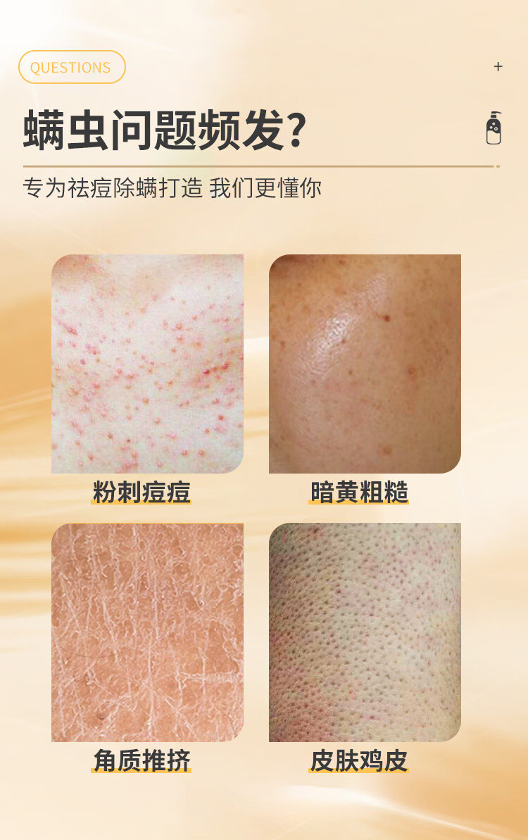 硫磺除螨沐浴露螨虫后背痘痘祛控油去多效沐浴皂液露滋润硫磺液体香皂男女 硫磺沐浴露x2瓶