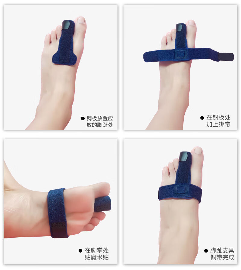 脚趾骨折支撑夹板大人脚趾支撑护具大中小五指弯曲固定带 升级款蓝色