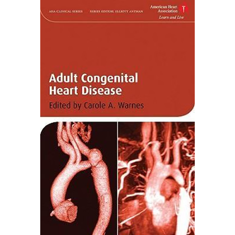 按需印刷Adult Congenital Heart Disease[9781405178204]