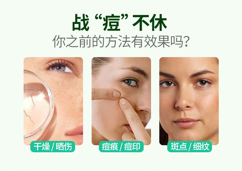 韩婵【发5支】水润芦荟胶补水保湿女男士通用晒后护理痘痘肌可用 40g/支
