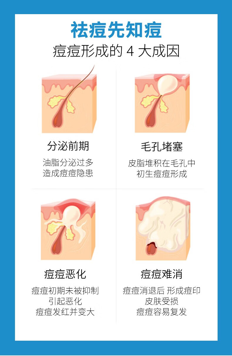RYDEEN水杨酸祛痘膏壬二酸凝胶清痘淡痘印去闭口抗痘男女清洁控油 特价1支20g