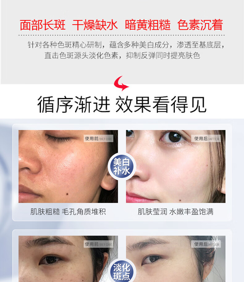 仁和药业 美白祛斑补水面膜 淡斑祛黄提亮保湿补水晒后美白面膜 男女士祛斑产品亮肤面膜 20片/盒