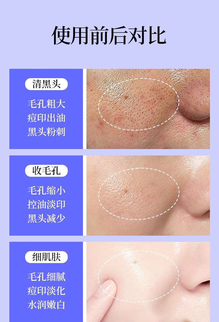 HMOT毛孔收缩精华液收敛毛孔粗大修复细致抗皱精华原液补水保湿男女士 1瓶体验装【推荐周期使用】