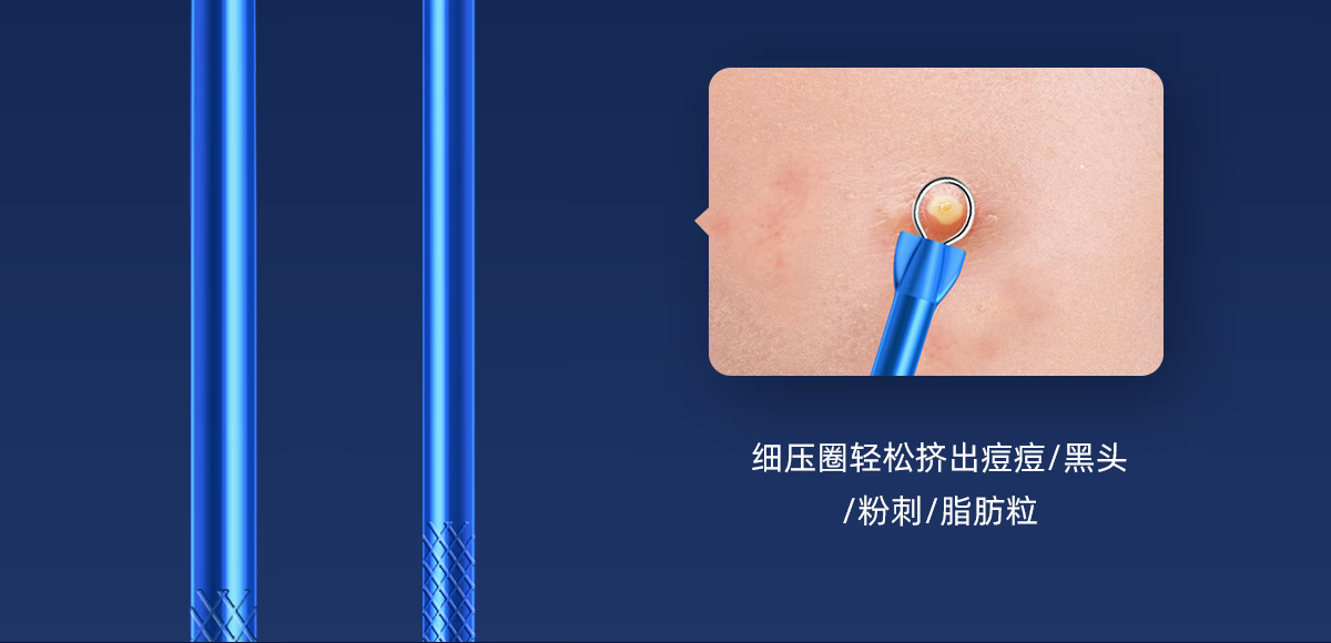 欧亿姿粉刺针套装细胞夹套装镊子祛黑头针粉刺痘痘超尖不锈钢美容院专用 尖嘴夹【单支套盒装】 #51