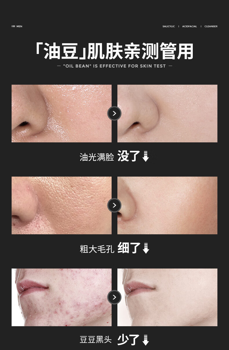 冰菊（BingJu）男女士水杨酸净颜洗面奶氨基酸补水保湿控油祛痘清洁洁面 500ml