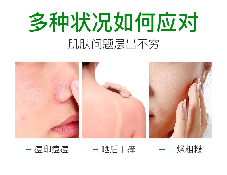 碧雅漫自然保湿芦荟胶涂抹式免洗补水收毛孔晒后修护男女通用 保湿芦荟胶40gX2支