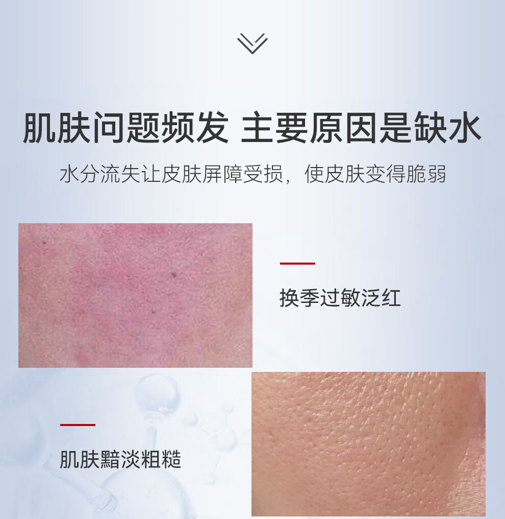 御简（UJ.LINCO）精萃水补水爽肤水保湿水舒缓镇静湿敷水玻尿酸毛孔收缩屏障修护 150ml