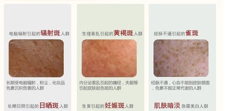 韩泊莉笑影冬虫夏草二合一美白祛斑霜套装淡斑保湿黄褐斑雀斑化妆品 日霜+日霜