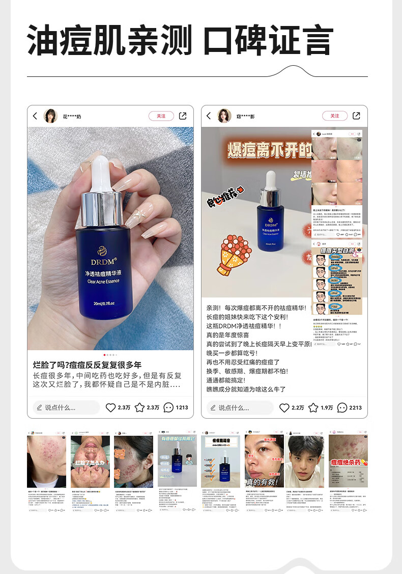 DRDM祛痘精华液水杨酸抗痘去闭口粉刺修护痘肌原液控油淡化痘印 20ml