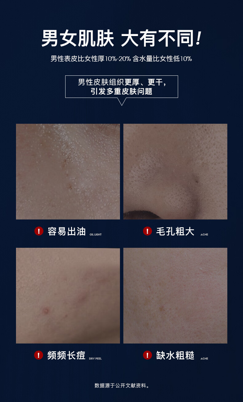 snns男士控油祛痘水乳护肤品套装清爽补水保湿水乳洗面奶3件礼盒 【控油抗痘TOP礼盒】水+乳+洁面