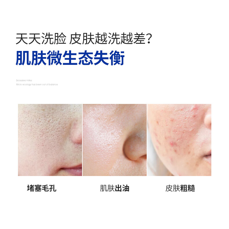 满婷氨基酸净澈清透洁面乳洗面奶温和养护去油深层除螨去螨虫皂男女士 氨基酸洗面奶 1支