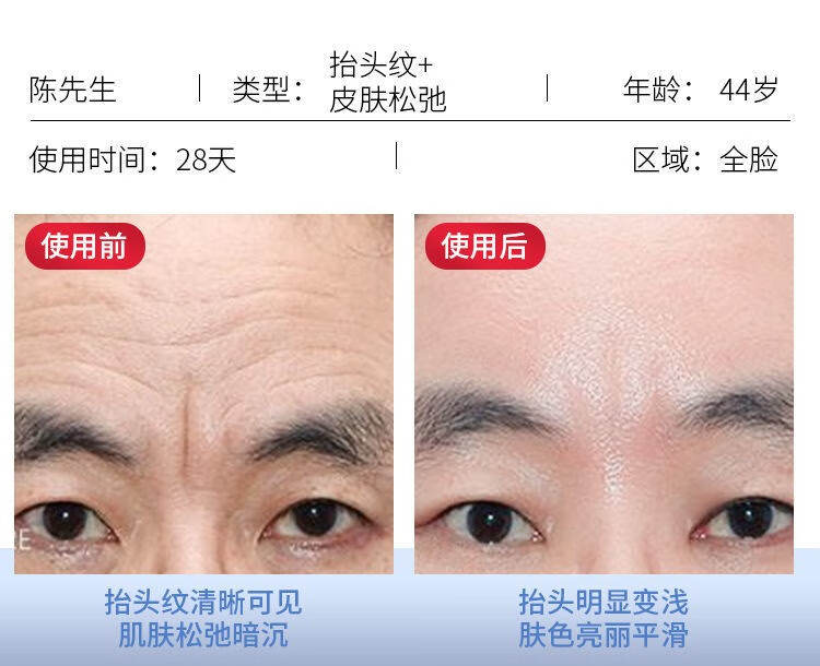 人仁和匠心 六胜肽抗皱面霜抗皱紧致保湿补水保湿护肤淡化法令纹额头纹 抗皱面霜50g