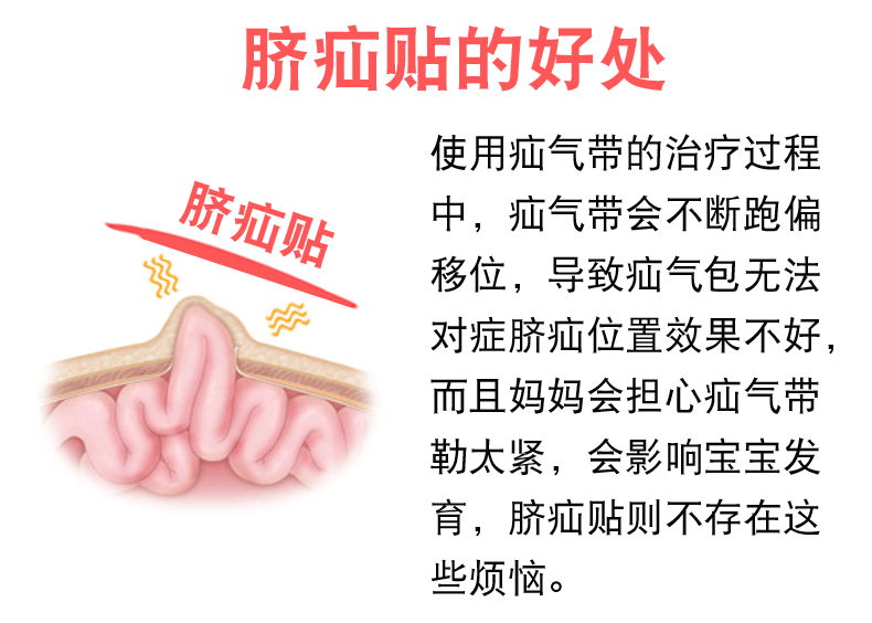 型凸肚脐突出贴疝气带透气包10天疗程20片脐疝贴1小疝气包1吸水包均码