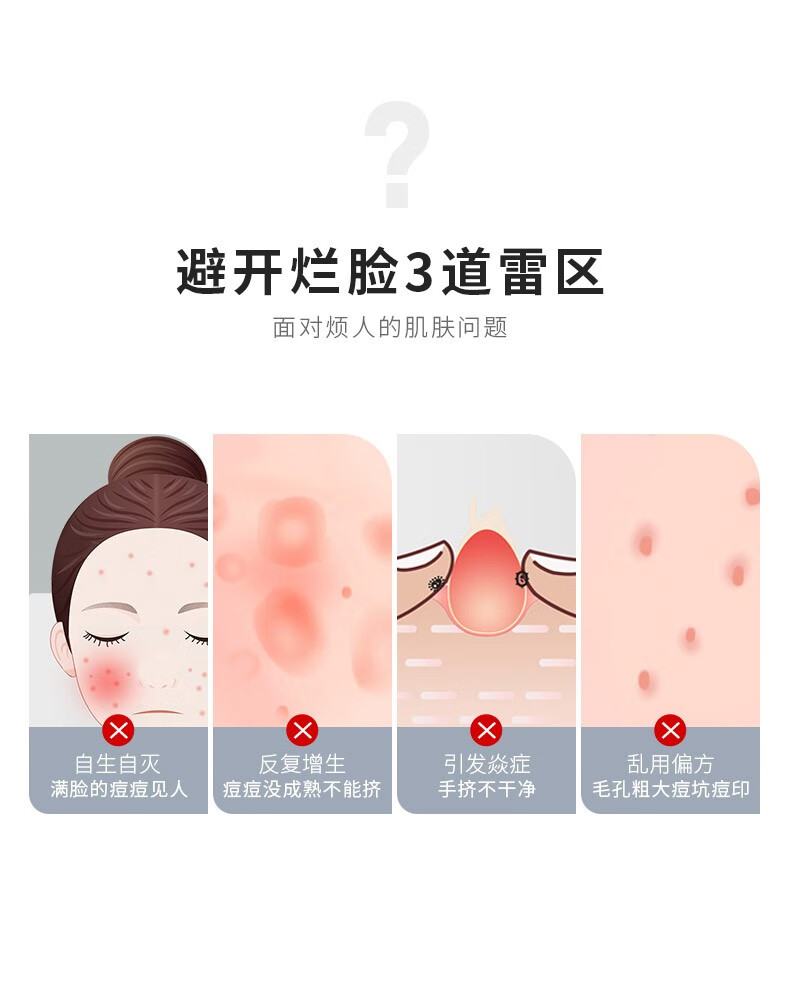 妙倩 银色粉刺针套装细胞夹黑头夹挤痘针镊子美容针脂肪粒清理工具 粉刺针4件套+细胞夹3件套