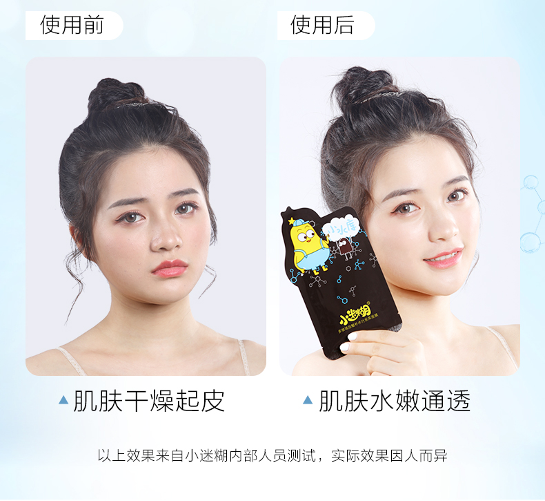 小迷糊 多维玻尿酸补水竹炭黑面膜补水痘印暗沉收缩毛孔保湿夏季 1盒