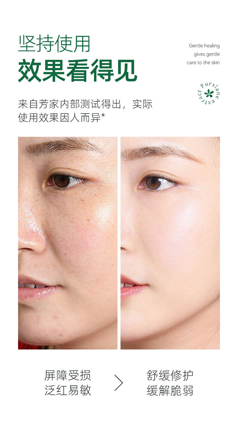 fUT马齿苋爽肤水补水喷雾舒缓敏易感肌泛红保湿敷护肤化妆水纯露男女 马齿苋纯露250ml