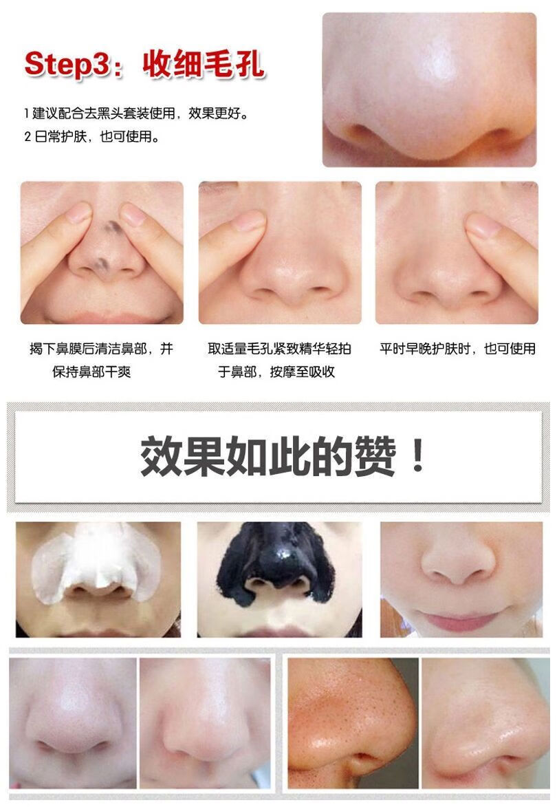 粉刺针细胞夹挤痘痘院专用去黑头暗疮针镊子工具套装网红网红黑头专业