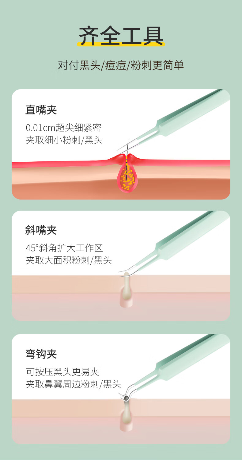 泉刃 粉刺针套装 黑头夹 挤痘痘工具套装 祛痘针 挑痘针 细胞夹 黑头粉刺清理套装 美容工具套装 豪华痘痘终结6件套-墨绿色