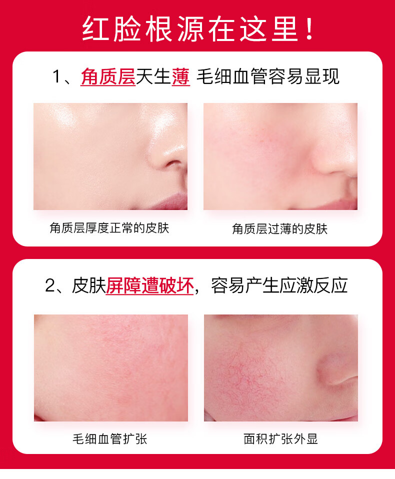 珀芙研珀芙研舒缓保湿修护乳霜 修护肌肤屏障敏感肌728面霜 舒缓保湿修护728霜15g