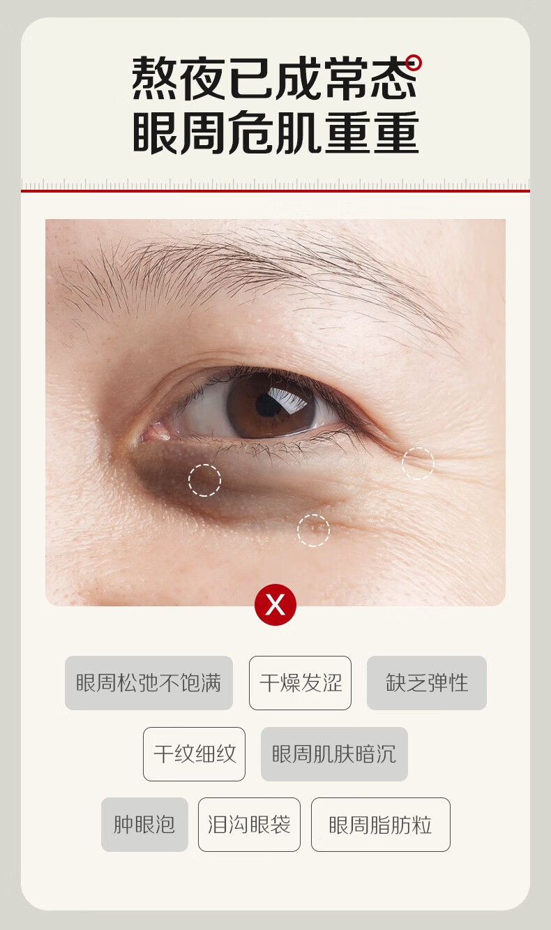 瑜然美眼部精华油紧致抗皱修护疲劳补水淡化鱼尾纹纹细纹眼袋液黑眼圈女 1瓶【润泽眼底】