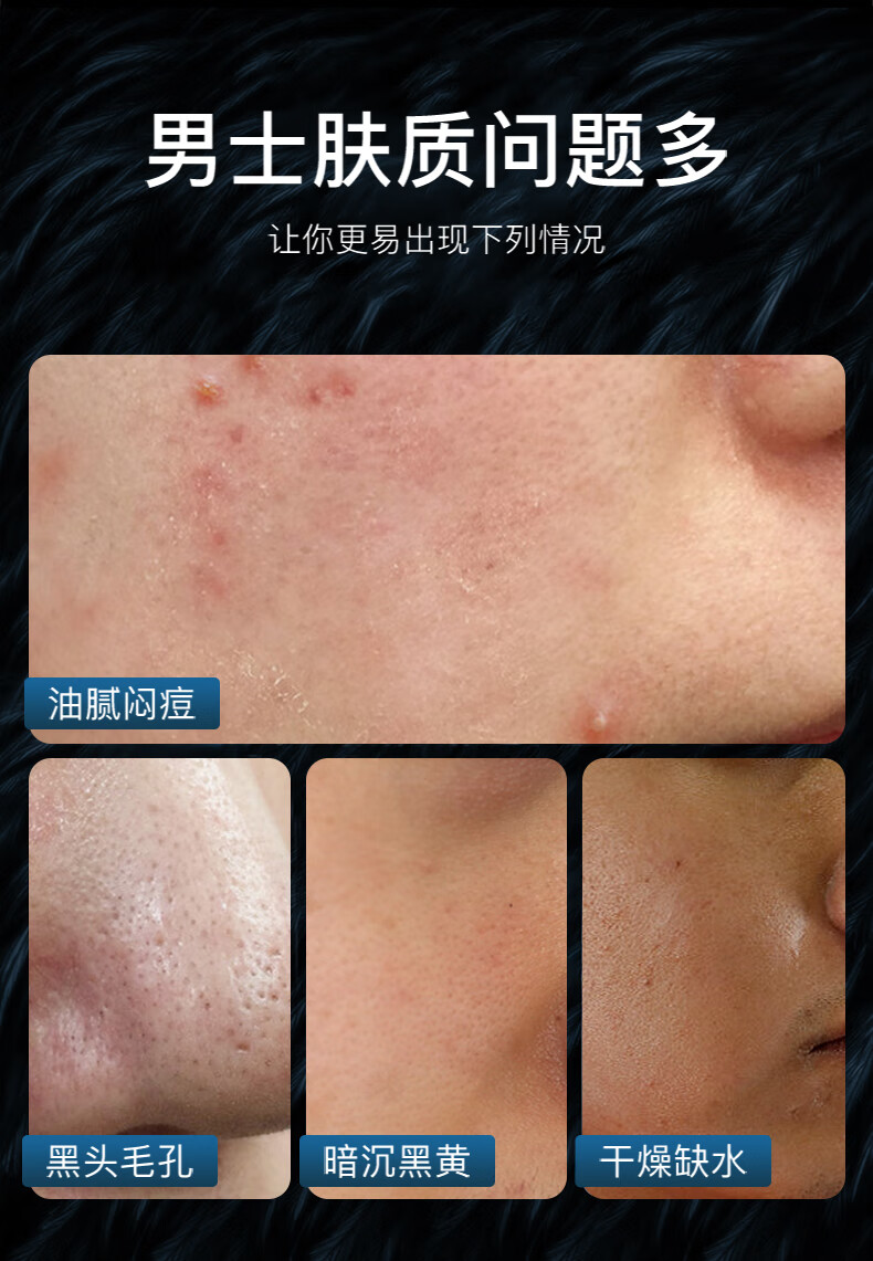 梵贞 男士护肤礼盒 补水保湿控油洗面奶擦脸油精华水乳套装学生护肤品 男士劲肤清爽三件套礼盒