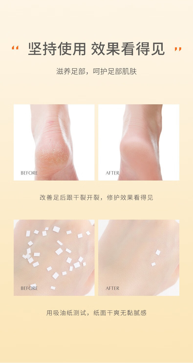 伈榈途 足跟皴裂修复凝露防裂去死皮脚后跟起皮滋润滚珠凝露 2支【走珠款】实惠装