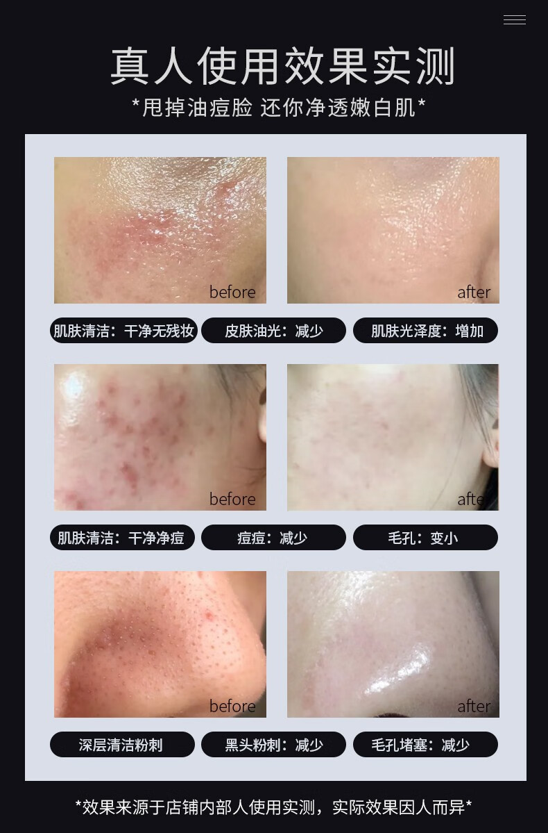 仁和 植物复合净颜洁面乳控油祛痘深层清洁毛孔男女通用160g/瓶 除螨洁面乳1瓶