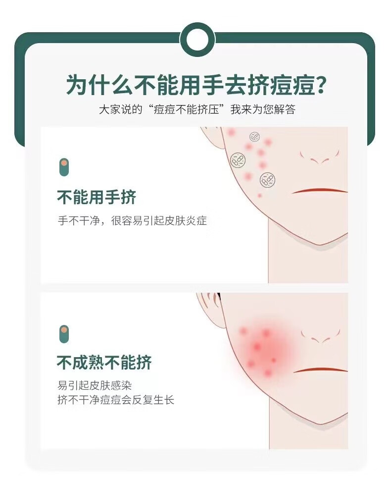 初觅 粉刺针套装细胞夹黑头针粉刺夹挤痘痘工具黑头夹暗疮针祛痘美容针挑痘挤痘针