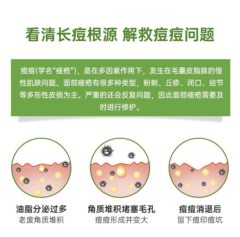 珂语（KEYU） 清痘调理凝胶焕颜祛痘精华净粉刺修护痘肌控油收敛毛孔 清痘调理凝胶1盒6支