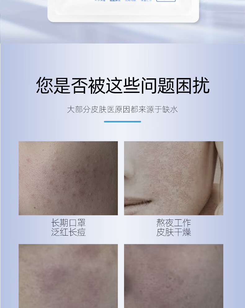 薇珀思（WEPERSE）贻贝精华面膜女补水保湿面膜敏感肌肤修护免洗熬夜护肤品生物纤维 单片