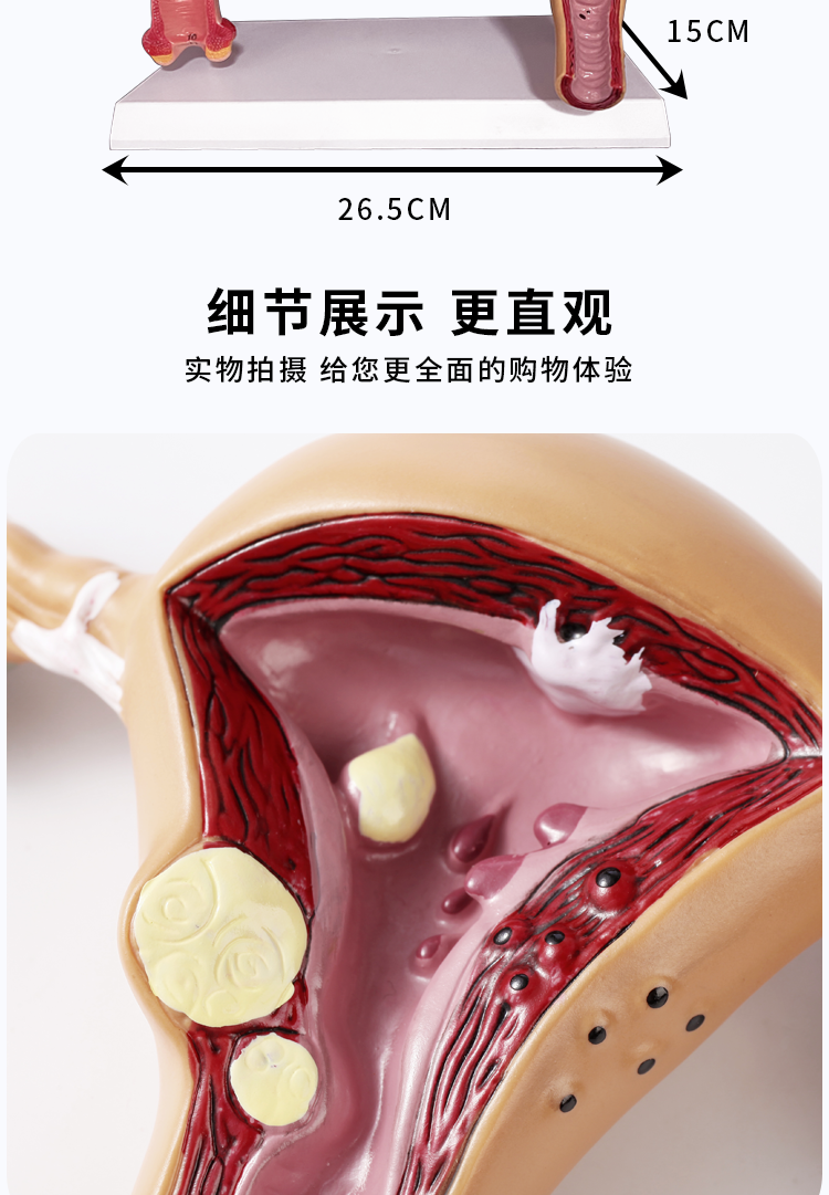 病理 卵巢2合一款子宫模型 带详解图【图片 价格 品牌 报价-京东