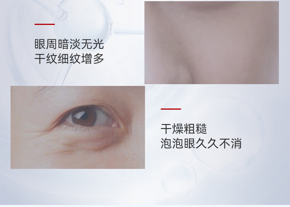 御简（UJ.LINCO）提拉眼霜滋润紧致淡化细纹黑眼圈抗皱提亮眼周部收缩毛孔补水保湿 15g