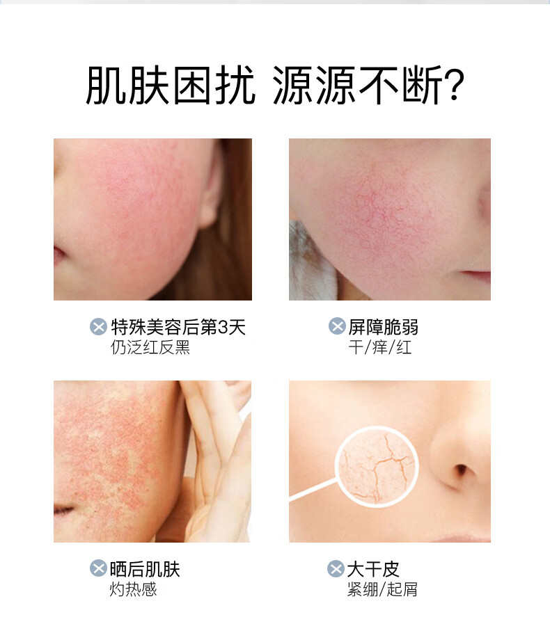 伊肤泉舒缓保湿面膜 补水修护敏感肌 积雪草护肤男女