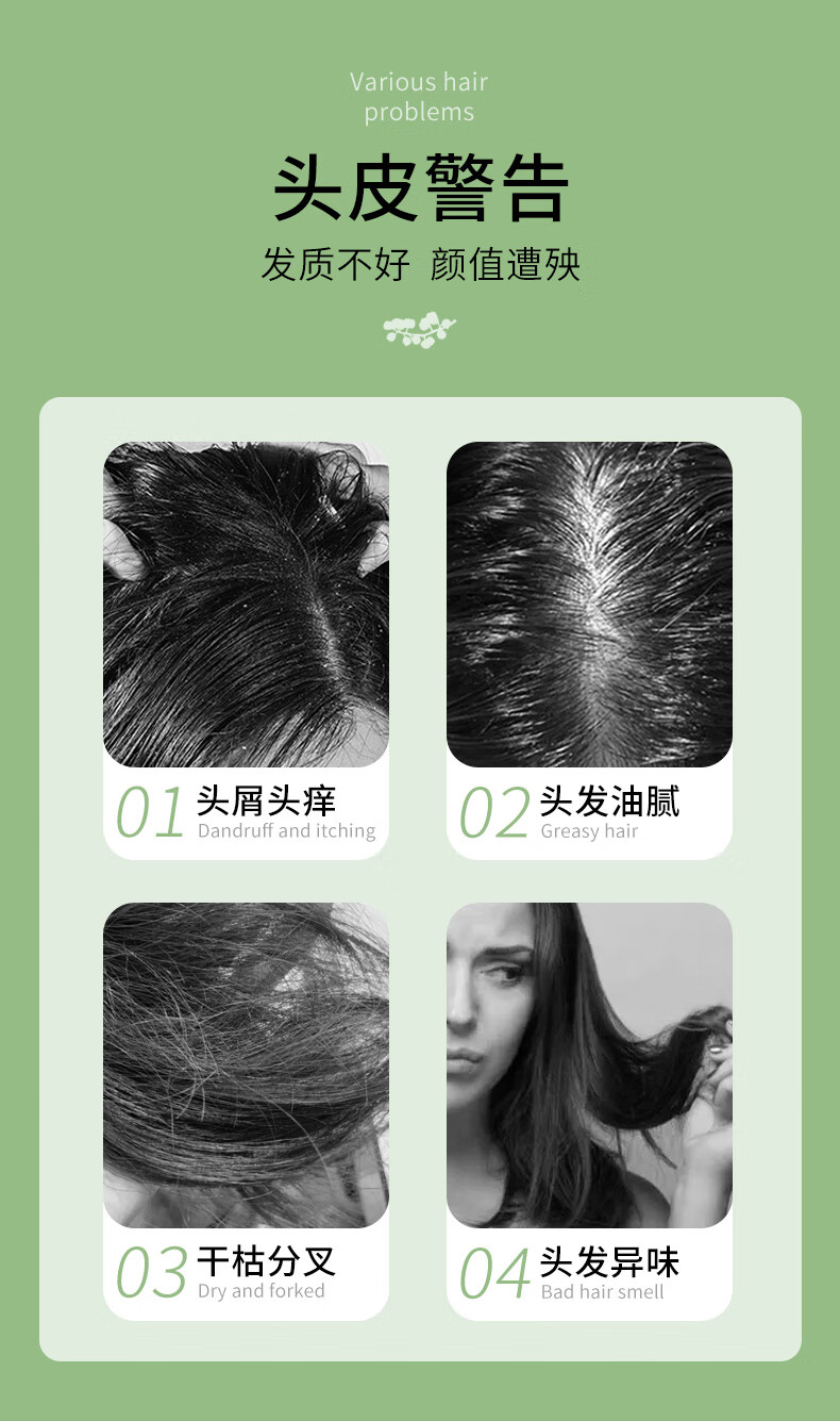 佰束除螨洗发水洗头皂控油止痒去屑露毛囊头部螨虫无硅油脂性头皮清洁 除螨洗发皂x1瓶.