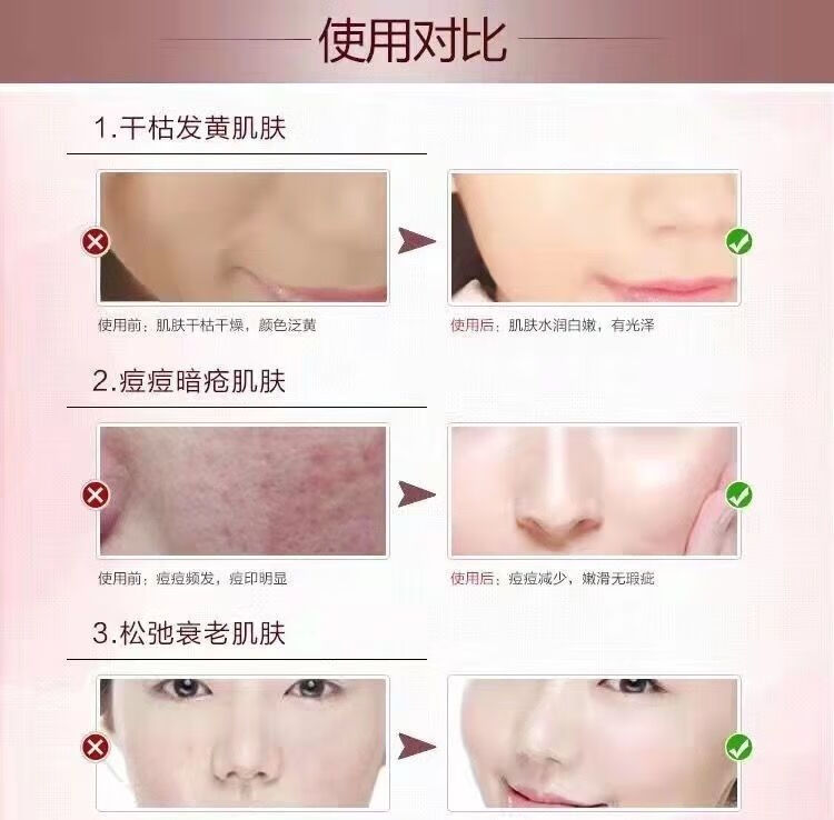 自然堂化妆品套装镁白补水保湿淡i斑抗皱紧致女士护肤品全套 三件套