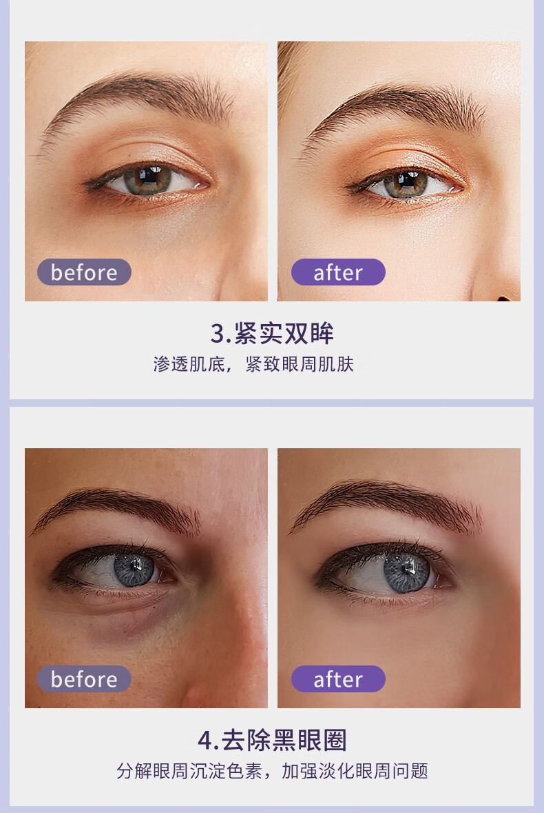 雪肌灵眼霜女淡化细纹提拉紧致黑眼圈眼袋保湿护肤品套装男女士生日礼物 眼霜套装【1按摩头+替换装】