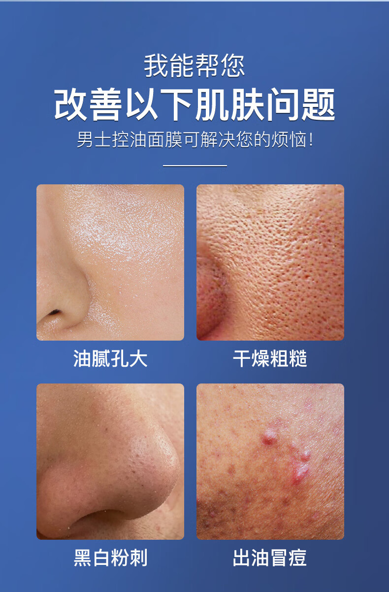 碧然堂男士面膜收缩毛孔清爽去控油痘印清洁黑头保湿补水面膜学生护肤品 男士控油净爽面膜25ml*14片*2盒