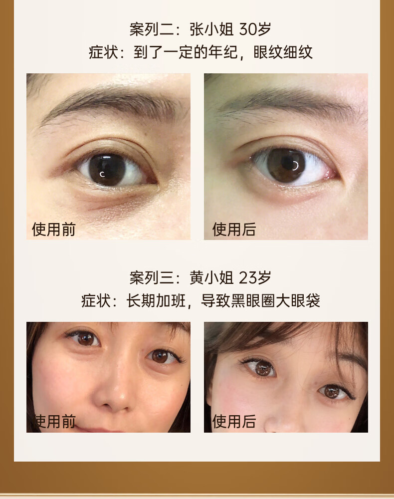 EEC小棕瓶精华奢宠眼霜15ml淡化细纹黑眼圈眼袋紧致男女 一瓶