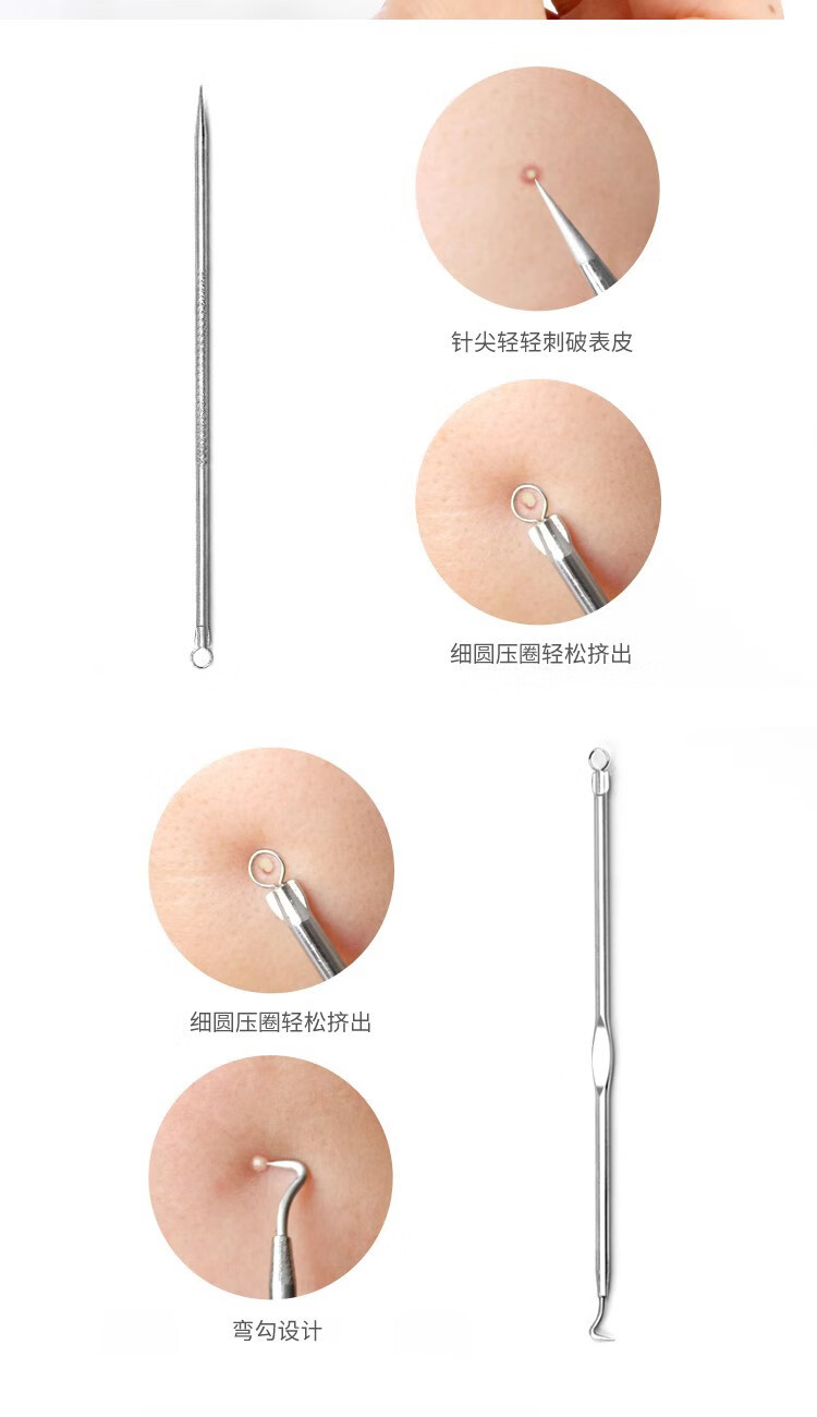 阿嚓热（ACARE）不锈钢粉刺针美容针暗疮针细胞夹套装家用挤痘痘工具 弯嘴夹+收纳盒