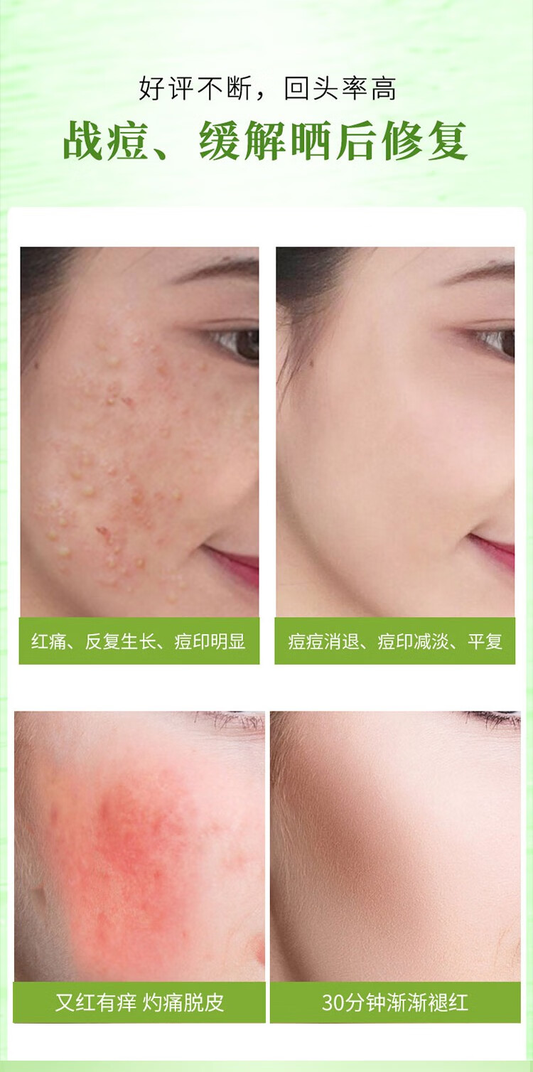 自然乐园（NATURE REPUBLIC）芦荟胶抗痘淡印舒缓保湿凝胶全身面部秋冬季补水面霜晒后修护 250ml