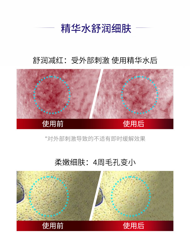 COCOAMELIA1970CCA玻色水乳精华套装焕颜嫩肤补水保湿提亮舒缓修护面部女 【三件套】水+乳+精华液