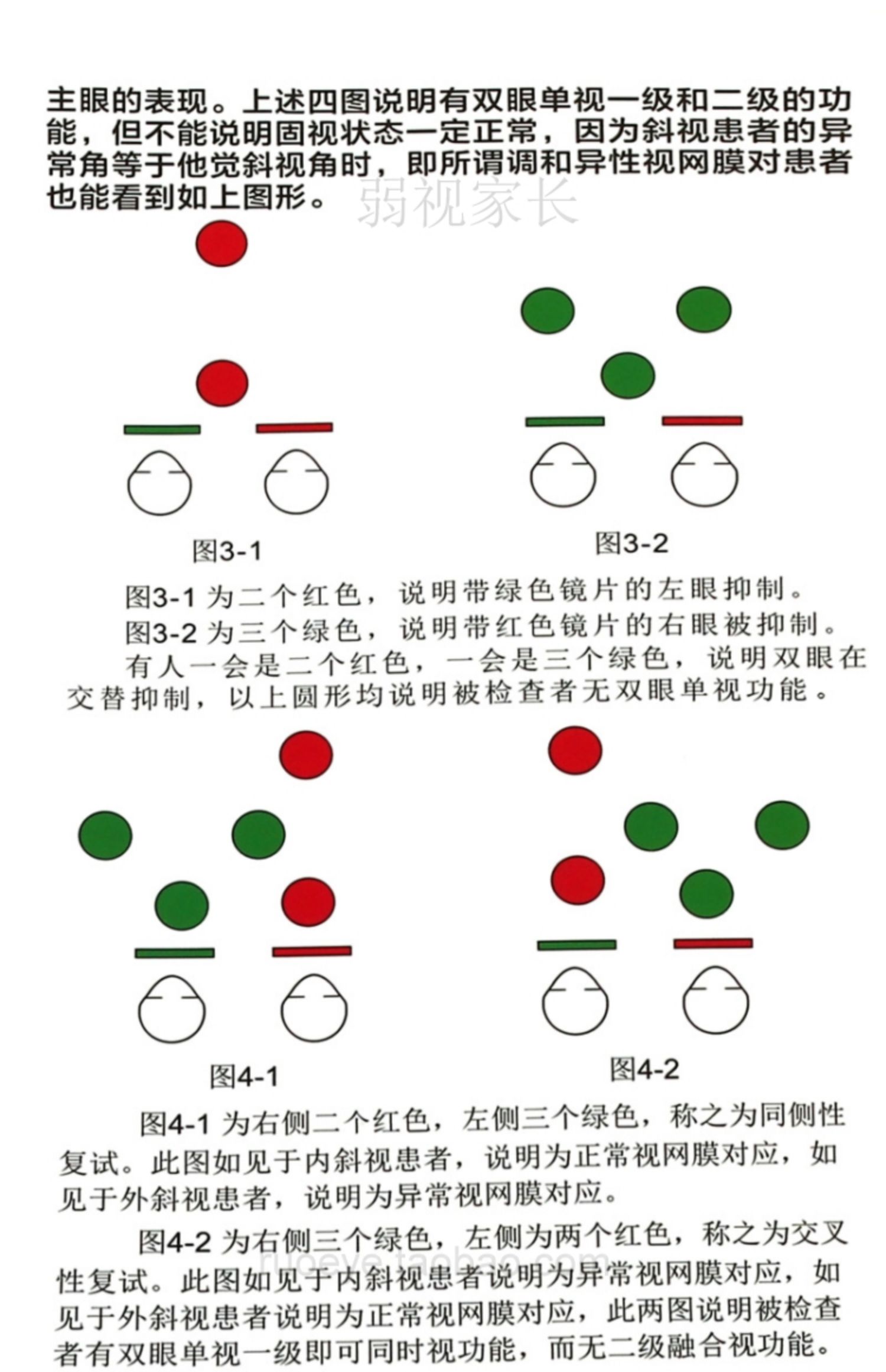 四孔灯红绿眼镜worth四点灯三级视功能眼抑制同时融合检查检测灯四孔