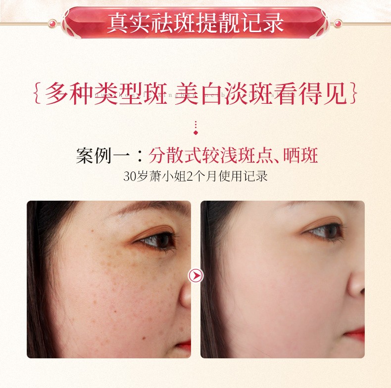 韩美肌（Hanmeiji）美白祛斑补水面膜提亮保湿补水男女 40片