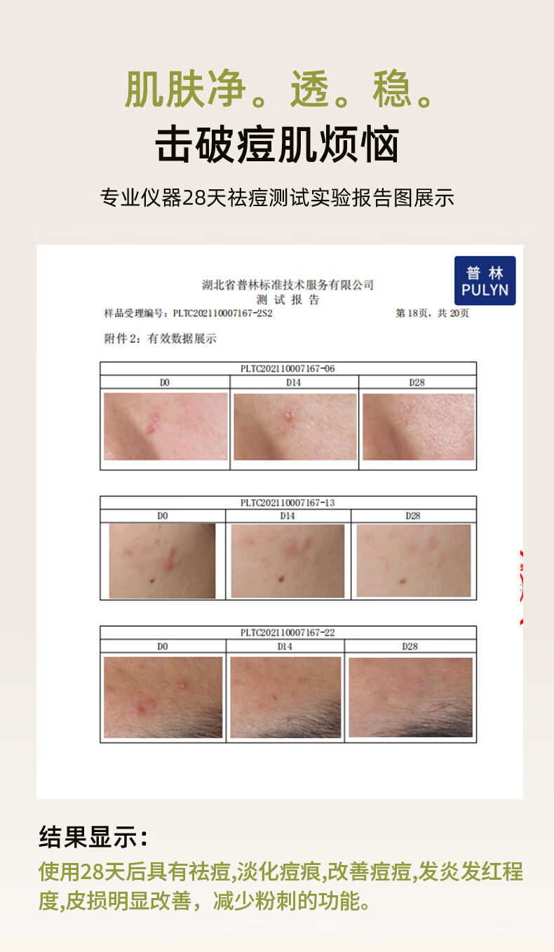 美洳活性肽祛痘精华液去祛痘印疤膏淡化痘坑修凹洞青春复痘男女士学生 一瓶标准装 30ml