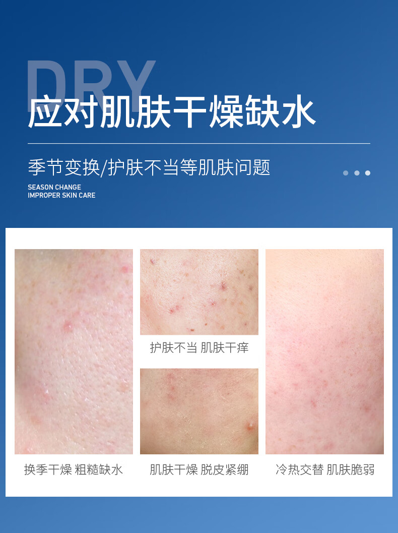 形象美（images） 【实发2瓶】形象美 凡士林保湿霜 干燥起皮润肤乳滋润保湿170g 形象美 凡士林保湿霜1瓶