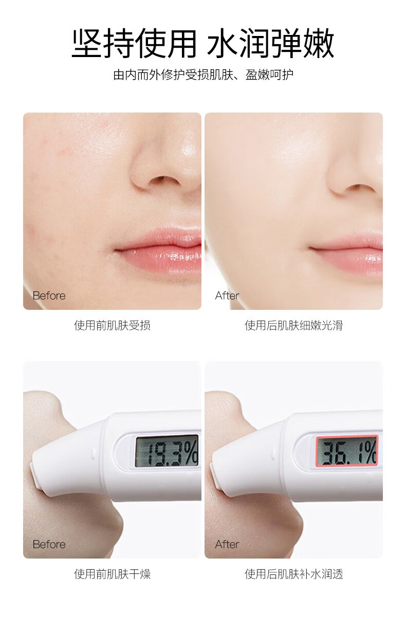 谜草集花青素多肽补水七件套保湿滋润锁水夏季护肤化妆品套装 花青素多肽补水七件套