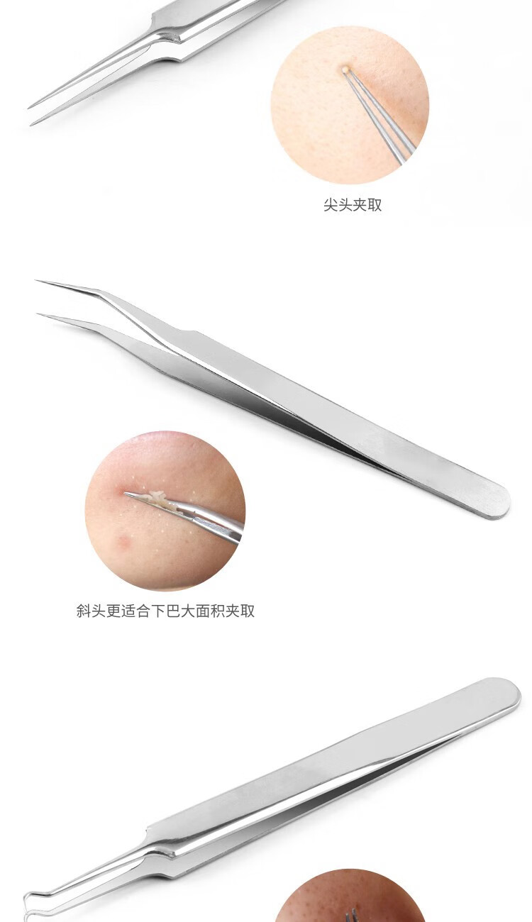 阿嚓热（ACARE）不锈钢粉刺针美容针暗疮针细胞夹套装家用挤痘痘工具 弯嘴夹+收纳盒